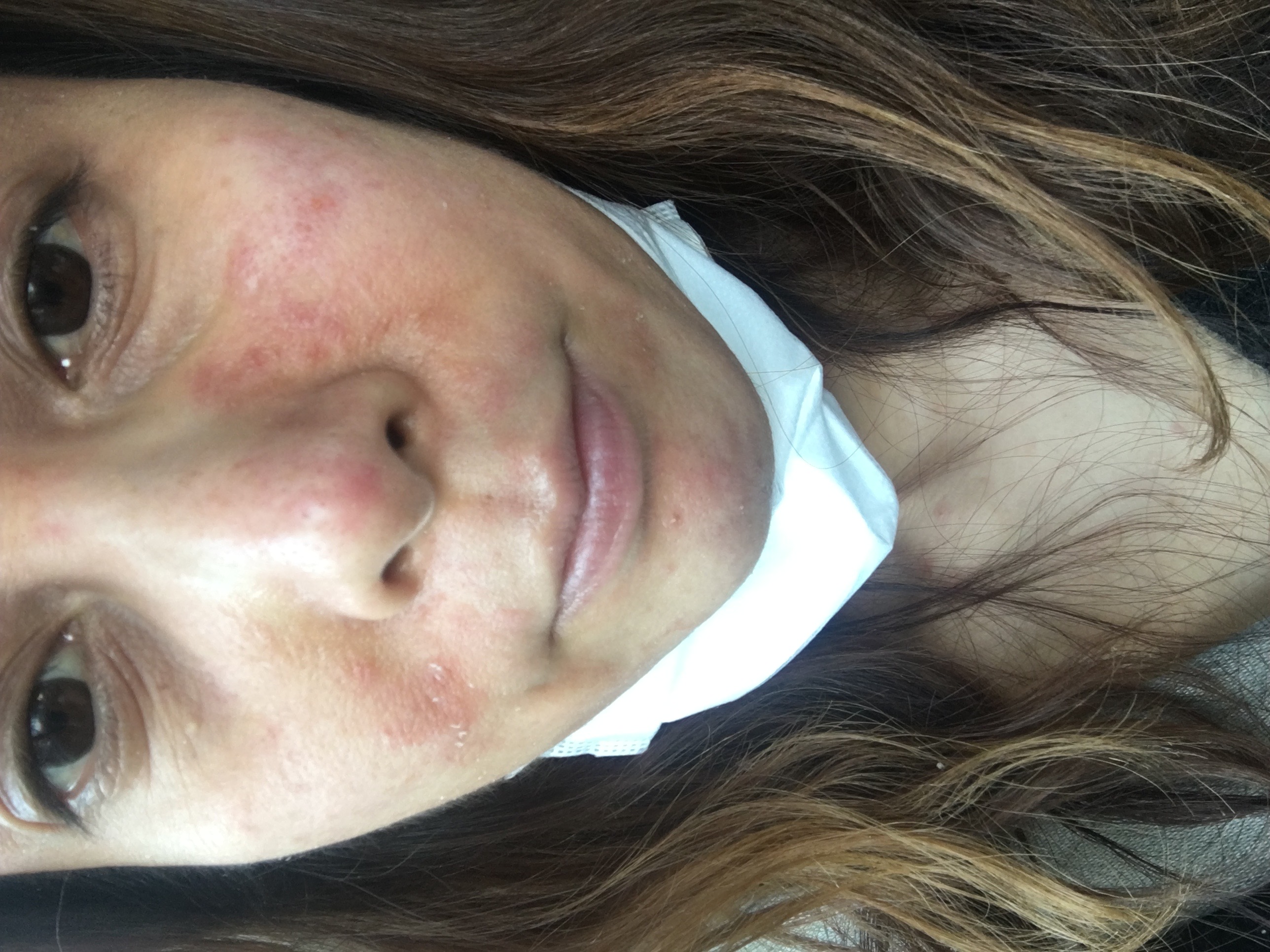 原因不明の体調不良と栄養との出会い